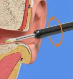 Wireless WIFI Visual Ear Pick - Image 5